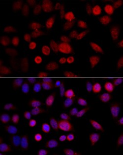 Invitrogen CYP1B1 Polyclonal Antibody 100 &mu;L | Buy Online | Invitrogen&trade; | Fisher Scientific
