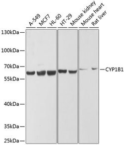 Invitrogen CYP1B1 Polyclonal Antibody 100 &mu;L | Buy Online | Invitrogen&trade; | Fisher Scientific