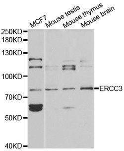 Invitrogen XPB Polyclonal Antibody 100 &mu;L; Unconjugated:Antibodies,