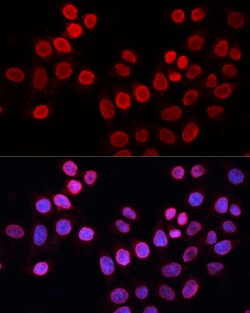 Invitrogen XPG Polyclonal Antibody 100 &mu;L | Buy Online | Invitrogen&trade; | Fisher Scientific