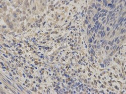 Invitrogen GABRA2 Polyclonal Antibody 100 &mu;L; Unconjugated:Antibodies,