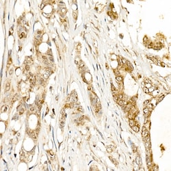 Invitrogen Kallikrein 1 Polyclonal Antibody 100 &mu;L; Unconjugated:Antibodies,