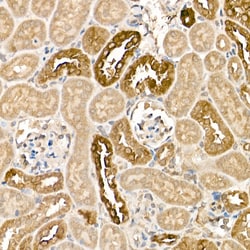 Invitrogen Kallikrein 1 Polyclonal Antibody 100 &mu;L; Unconjugated:Antibodies,