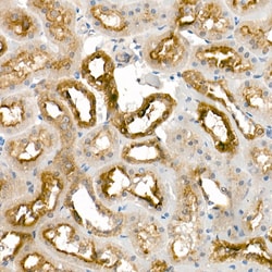 Invitrogen Kallikrein 1 Polyclonal Antibody 100 &mu;L; Unconjugated:Antibodies,
