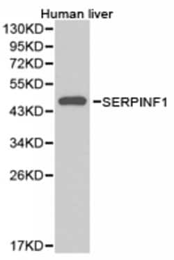 Invitrogen PEDF Polyclonal Antibody 100 &mu;L; Unconjugated:Antibodies,