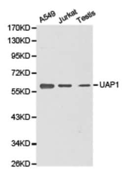 Invitrogen UAP1 Polyclonal Antibody 100 &mu;L; Unconjugated:Antibodies,
