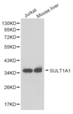 Invitrogen SULT1A1 Polyclonal Antibody 100 &mu;L; Unconjugated:Antibodies,