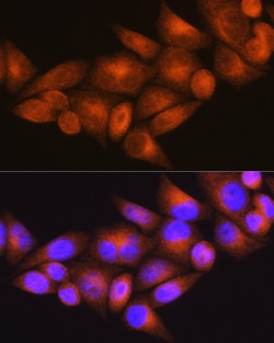Invitrogen WFS1 Polyclonal Antibody 100 &mu;L; Unconjugated:Antibodies,