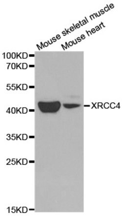 Invitrogen XRCC4 Polyclonal Antibody 100 &mu;L; Unconjugated:Antikörper