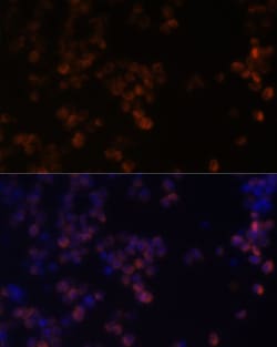 Invitrogen Zyxin Polyclonal Antibody 100 &mu;L | Buy Online | Invitrogen&trade; | Fisher Scientific