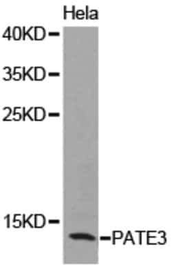 Invitrogen PATE3 Polyclonal Antibody 100 &mu;L; Unconjugated:Antibodies,