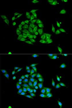 Invitrogen PICK1 Polyclonal Antibody 100 &mu;L; Unconjugated:Antibodies,
