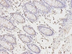 Invitrogen PICK1 Polyclonal Antibody 100 &mu;L; Unconjugated:Antibodies,