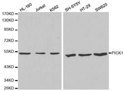 Invitrogen PICK1 Polyclonal Antibody 100 &mu;L; Unconjugated:Antibodies,