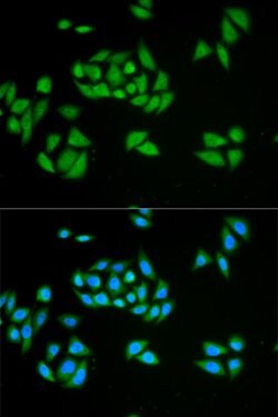 UPF1 Polyclonal Antibody:Antibodies, Polyclonal