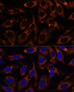 Invitrogen TCP-1 gamma Polyclonal Antibody 100 &mu;L; Unconjugated:Antibodies,