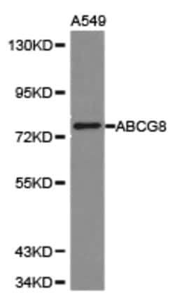 Invitrogen ABCG8 Polyclonal Antibody 100 &mu;L | Buy Online | Invitrogen&trade; | Fisher Scientific