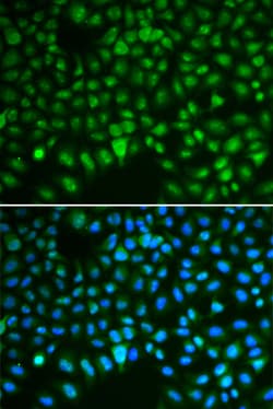 Invitrogen DLG7 Polyclonal Antibody 100 &mu;L; Unconjugated:Antibodies,