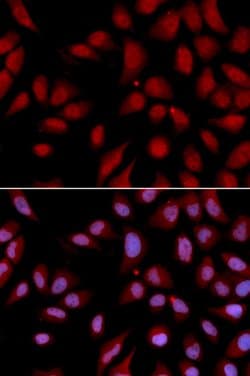 Invitrogen DLG7 Polyclonal Antibody 100 &mu;L; Unconjugated:Antibodies,
