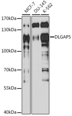 Invitrogen DLG7 Polyclonal Antibody 100 &mu;L; Unconjugated:Antibodies,