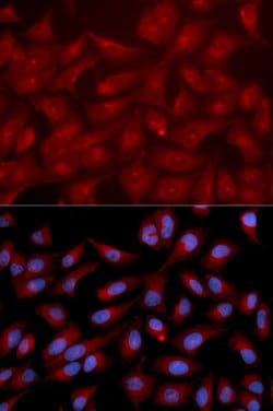 Invitrogen RAPGEF3 Polyclonal Antibody 100 &mu;L; Unconjugated:Antibodies,