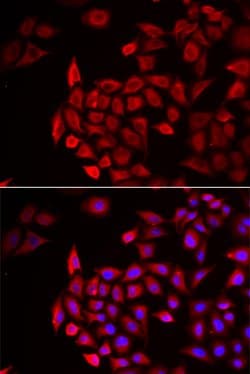 Invitrogen COCH Polyclonal Antibody 100 &mu;L; Unconjugated:Antibodies,