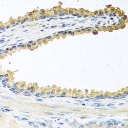 Invitrogen COCH Polyclonal Antibody 100 &mu;L; Unconjugated:Antibodies,