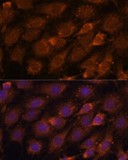Invitrogen LZIP Polyclonal Antibody 100 &mu;L; Unconjugated:Antibodies,