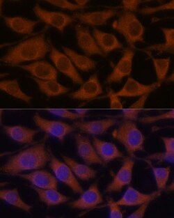 Invitrogen LZIP Polyclonal Antibody 100 &mu;L; Unconjugated:Antibodies,