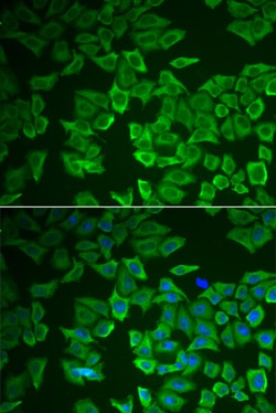Invitrogen CRHBP Polyclonal Antibody 100 &mu;L; Unconjugated:Antibodies,