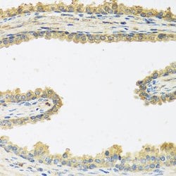 Invitrogen CRHBP Polyclonal Antibody 100 &mu;L; Unconjugated:Antibodies,