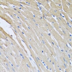Invitrogen CRHBP Polyclonal Antibody 100 &mu;L; Unconjugated:Antibodies,