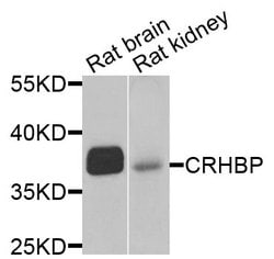 Invitrogen CRHBP Polyclonal Antibody 100 &mu;L; Unconjugated:Antibodies,
