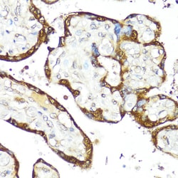Invitrogen IFNAR2 Polyclonal Antibody 100 &mu;L; Unconjugated:Antibodies,