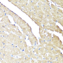 Invitrogen IFNAR2 Polyclonal Antibody 100 &mu;L; Unconjugated:Antibodies,