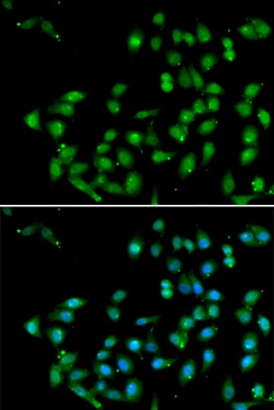 Invitrogen CTNNBL1 Polyclonal Antibody 100 &mu;L; Unconjugated:Antibodies,