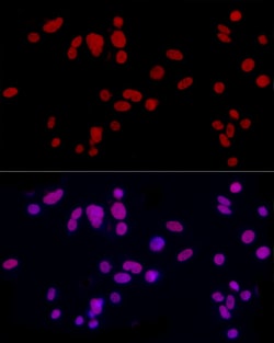 Invitrogen CREM Polyclonal Antibody 100 &mu;L; Unconjugated:Antibodies,