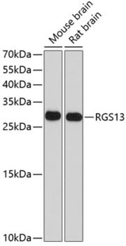 Invitrogen RGS13 Polyclonal Antibody 100 &mu;L; Unconjugated:Antibodies,