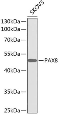 Invitrogen GNG7 Polyclonal Antibody 100 &mu;L; Unconjugated:Antibodies,