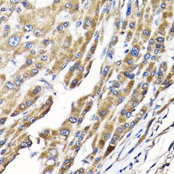 Invitrogen IKAP Polyclonal Antibody 100 &mu;L; Unconjugated:Antibodies,
