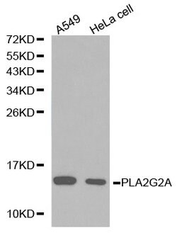 Invitrogen PLA2G2A Polyclonal Antibody 100 &mu;L; Unconjugated:Antibodies,