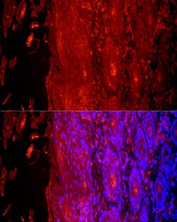 Invitrogen KRT9 Polyclonal Antibody 100 &mu;L; Unconjugated:Antibodies,