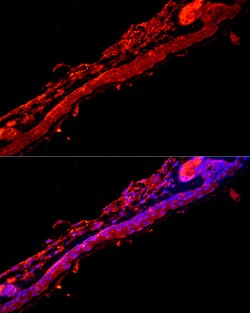 Invitrogen KRT9 Polyclonal Antibody 100 &mu;L; Unconjugated:Antibodies,