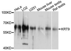 Invitrogen KRT9 Polyclonal Antibody 100 &mu;L; Unconjugated:Antibodies,