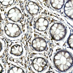 Invitrogen TEC Polyclonal Antibody 100 &mu;L | Buy Online | Invitrogen&trade; | Fisher Scientific