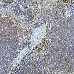 Invitrogen TEC Polyclonal Antibody 100 &mu;L | Buy Online | Invitrogen&trade; | Fisher Scientific