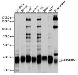 Invitrogen HERV-FRD Polyclonal Antibody 100 &mu;L; Unconjugated:Antibodies,