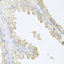 Invitrogen Calcineurin B Polyclonal Antibody 100 &mu;L; Unconjugated:Antibodies,
