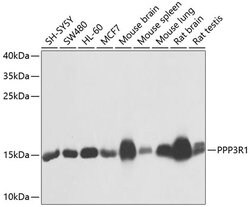 Invitrogen Calcineurin B Polyclonal Antibody 100 &mu;L; Unconjugated:Antibodies,