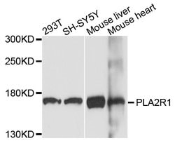 Invitrogen PLA2R1 Polyclonal Antibody 100 &mu;L; Unconjugated:Antibodies,